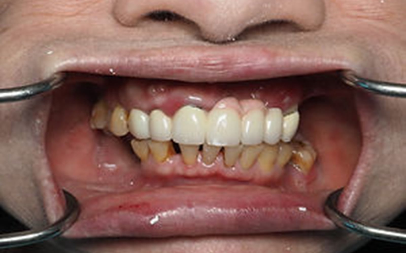 Featured Transformations case 1, before