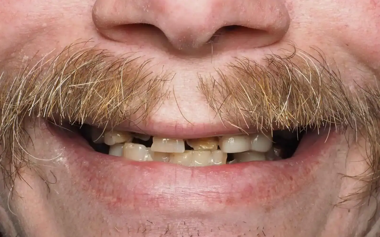 Featured Transformations case 2, before