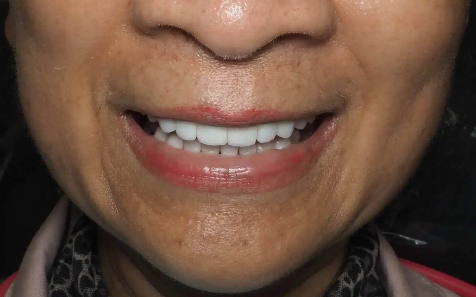 Featured Transformations case 3, after