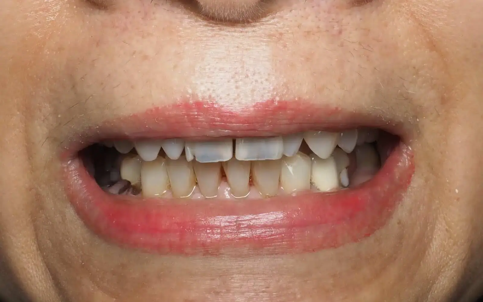 Featured Transformations case 3, before